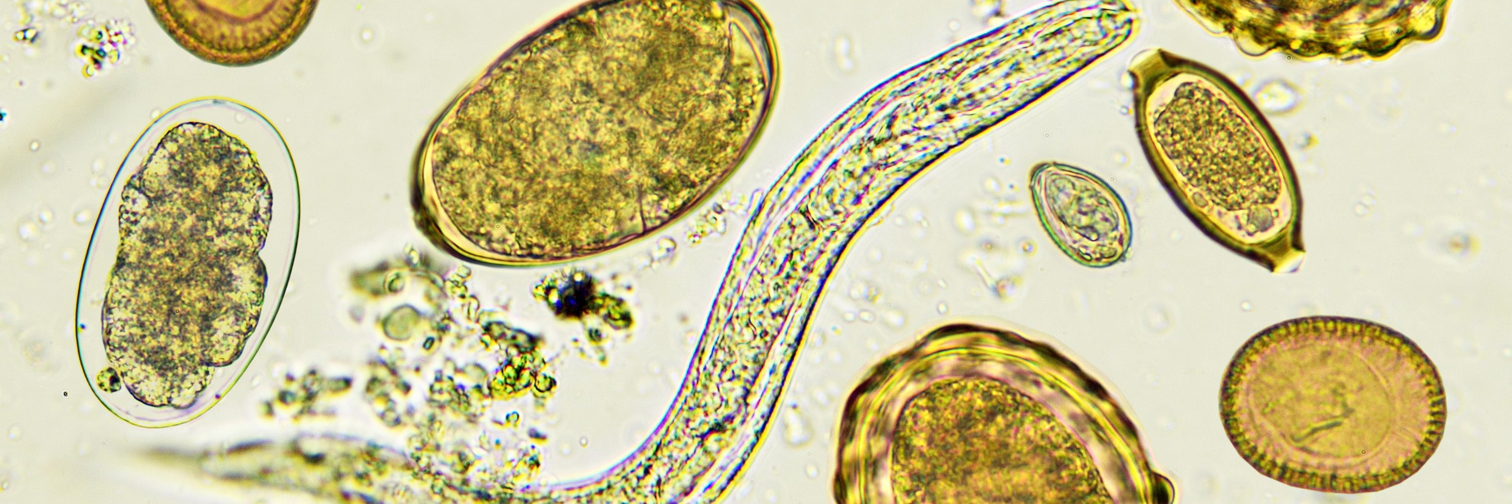 Würmer beim Huhn, Parasiten Huhn