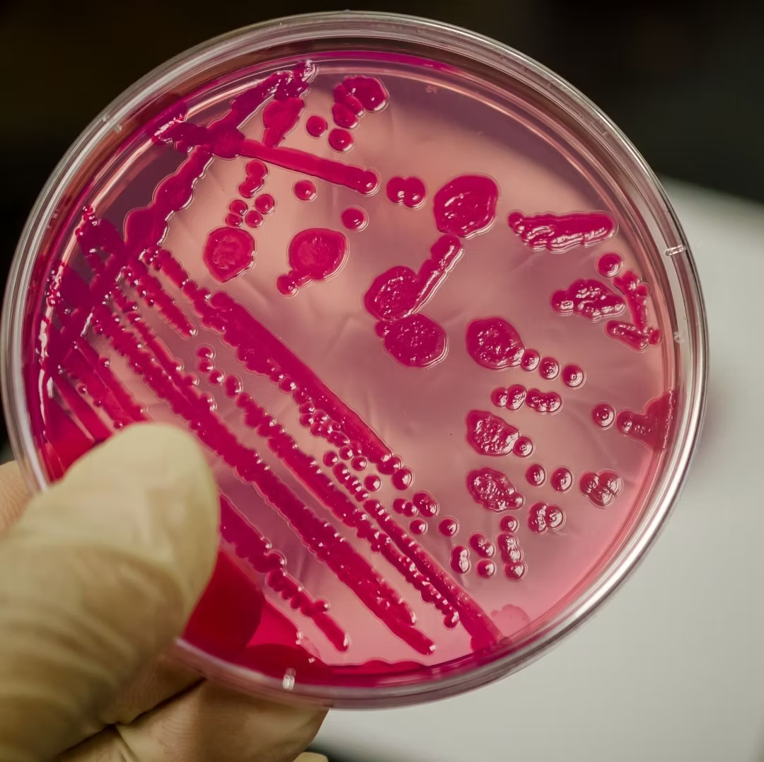 SalmoCheck – Kotuntersuchung auf Salmonellen bei Hühnern